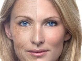 Пигментация на кожата