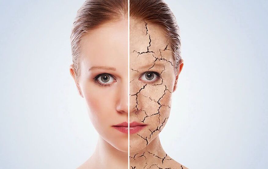 как да поддържаме кожата на лицето млада